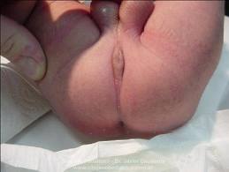 El dolor en el cuello la oreja y las sienes